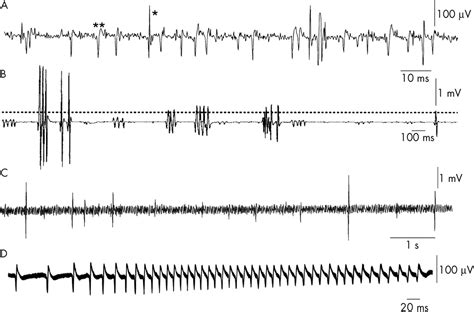 Image result for EMG Form