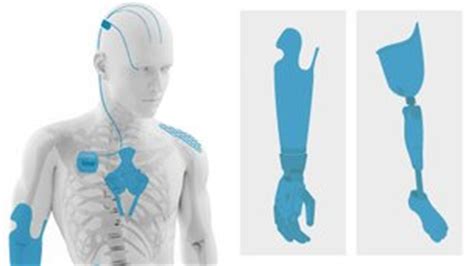 Bionic Body Parts に対する画像結果