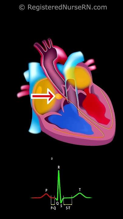Image result for Heart Conduction System Animation