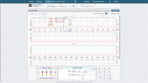 Image result for Dentrix Charting Tutorial