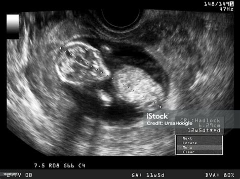 Afbeeldingsresultaten voor Ultrasound ID Code Roblox