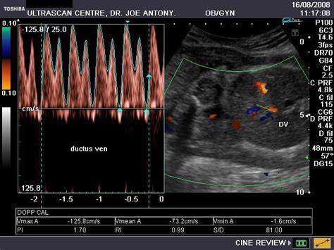 Afbeeldingsresultaten voor Ultrasound ID Code Roblox