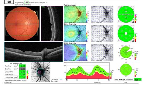 Vision Oct Test に対する画像結果