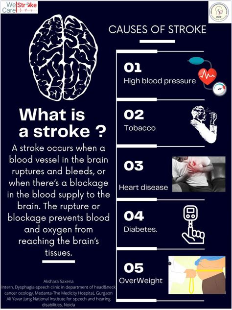 Toradh íomhá ar Stroke with Chart in Swiftui