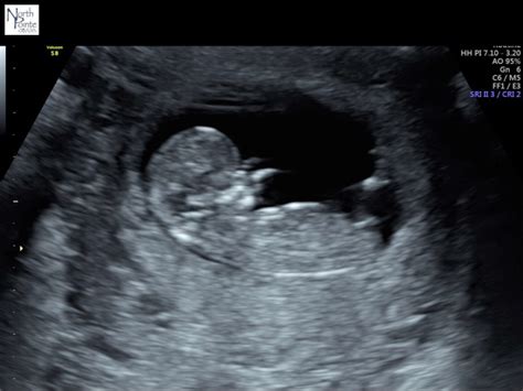 Afbeeldingsresultaten voor Ultrasound ID Code Roblox