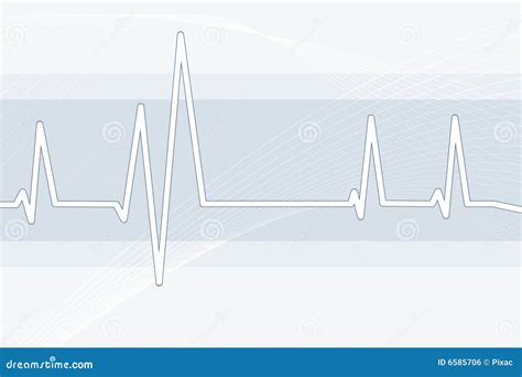 Image result for Sawtooth Waveform Drawing