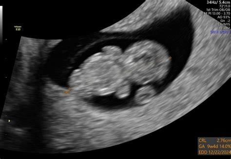 Afbeeldingsresultaten voor Ultrasound ID Code Roblox