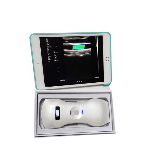 Image result for iPhone Ultrasound Probe