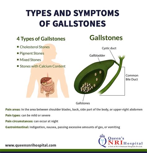 Image result for Gallbladder Skin Rash