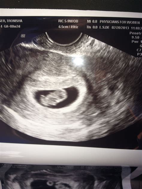 Afbeeldingsresultaten voor Ultrasound ID Code Roblox