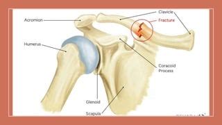 IP Lab Exercise 7에 대한 이미지 결과