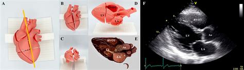 Image result for Ultrasound Probe Heart