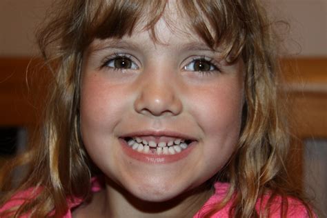 First Tooth Taken Out に対する画像結果