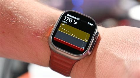 Image result for Dexcom G7 Pixel Watch