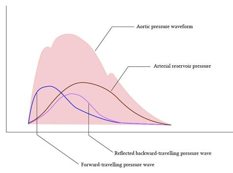 Toradh íomhá ar Normal Arterial Waveform