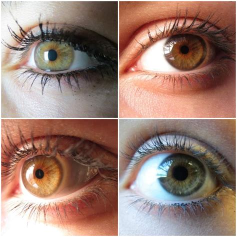 Eye Color Different に対する画像結果