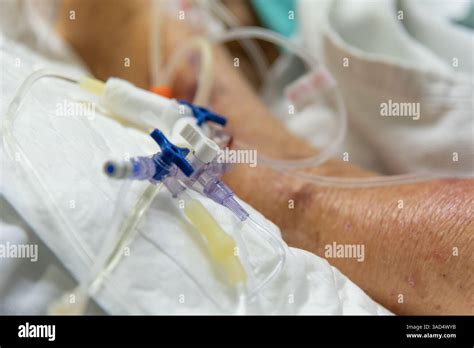 Afbeeldingsresultaten voor How to Use Ventilator