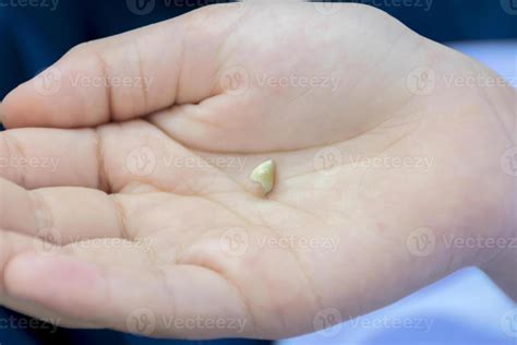 First Tooth Taken Out に対する画像結果