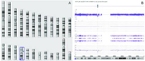 Chromosome Microarray に対する画像結果