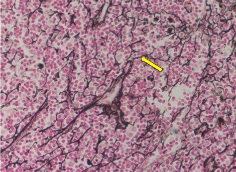 Afbeeldingsresultaten voor Reticular Connective Tissue