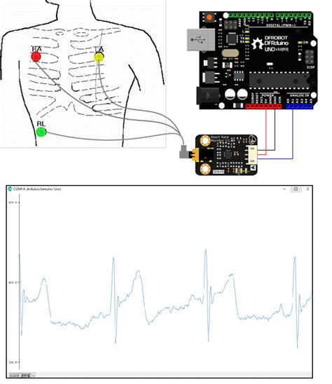 Afbeeldingsresultaten voor Heart Rate Monitor for Arduino Board