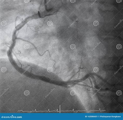 Angiography に対する画像結果