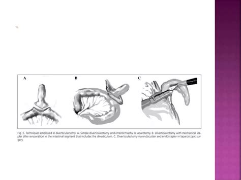 Image result for Git Pathology Lecture