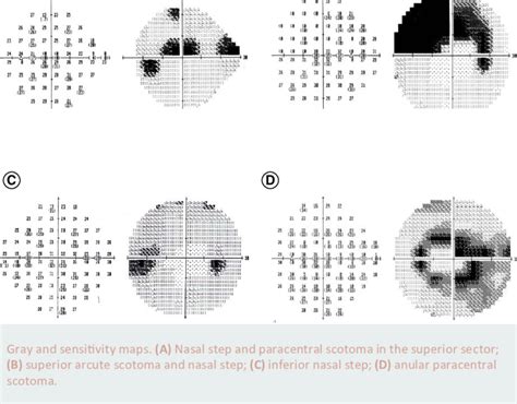 Image result for Aion Visual Field