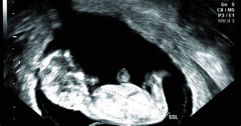 Afbeeldingsresultaten voor Ultrasound ID Code Roblox