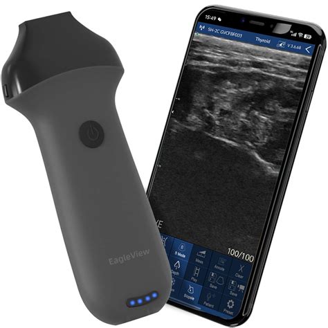 Image result for iPhone Ultrasound Probe