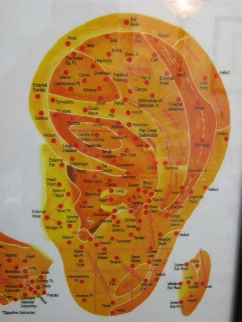 Image result for Theraputic Practice Map