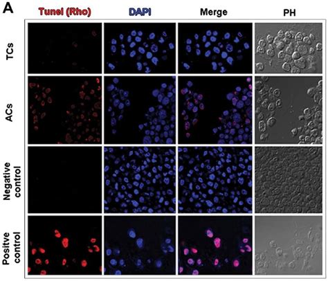 Tunel Assay に対する画像結果