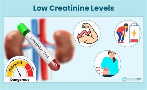 Afbeeldingsresultaten voor Normal Creatinine Levels Chart