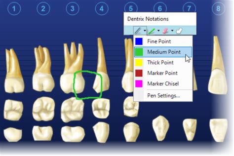 Image result for Dentrix Charting Tutorial