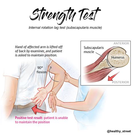 Afbeeldingsresultaten voor Lag Test Shoulder Pain