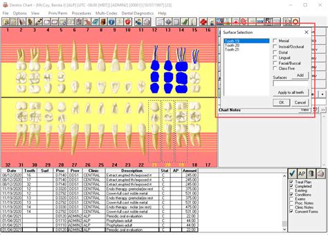 Image result for Dentrix Charting Tutorial
