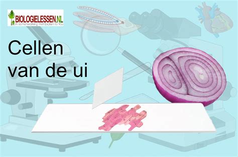 Image result for Vliesje UI