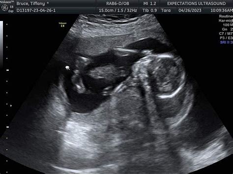 Afbeeldingsresultaten voor Ultrasound ID Code Roblox