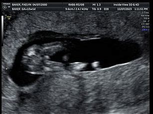 Afbeeldingsresultaten voor Ultrasound ID Code Roblox