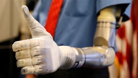 Bionic Body Parts に対する画像結果