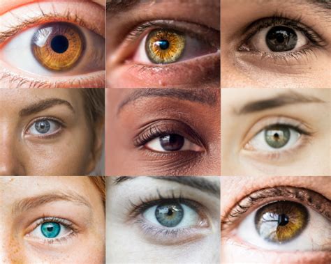 Eye Color Different に対する画像結果
