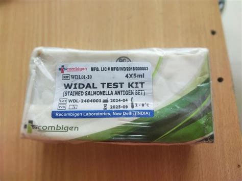 Toradh íomhá ar Widal Lab Test