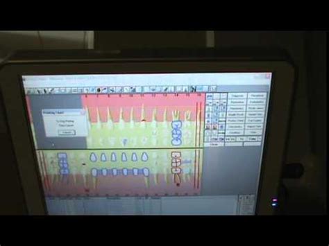 Image result for Dentrix Charting Tutorial