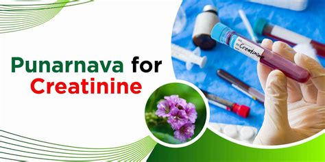 Afbeeldingsresultaten voor Normal Creatinine Levels Chart