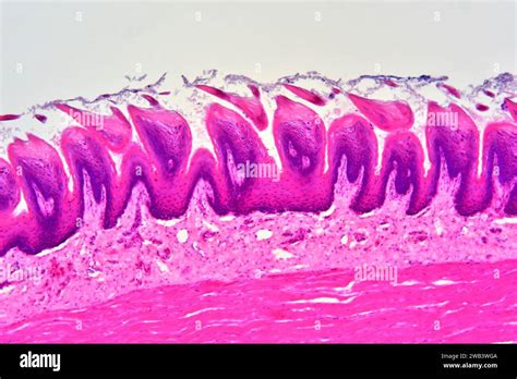 Toradh íomhá ar Filiform Papillae