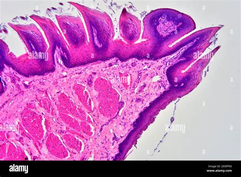 Toradh íomhá ar Filiform Papillae