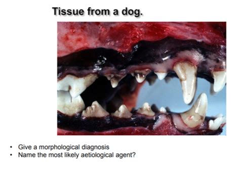 Cryptococcus Git Pathology માટે ઇમેજ પરિણામ