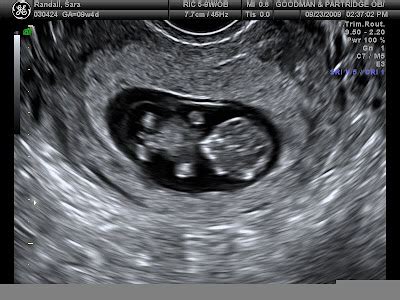 Afbeeldingsresultaten voor Ultrasound ID Code Roblox