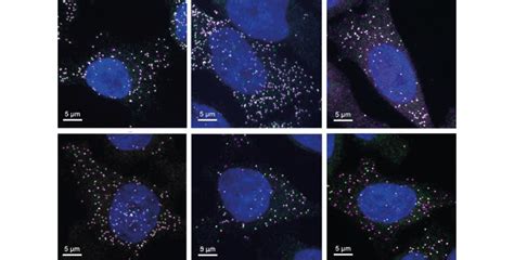 Image result for Translatie RNA