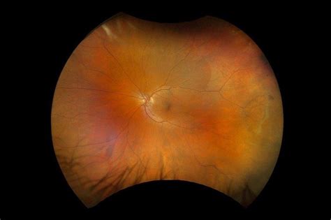 Image result for Rop Optos